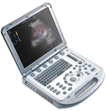 Chiropractic Germantown MD Muscuoloskeletal Ultrasound Monitor